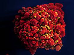 scanning electron micrograph of an hiv infected h9 t cell