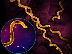 electron micrograph imagery of treponema pallidum the bacteria that cause syphilis including a foreground close up of a single particle spiral shaped bacteria are colorized in gold