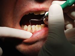 zahnarzt untersuchung in zahnarzt praxis copyright xzoonar