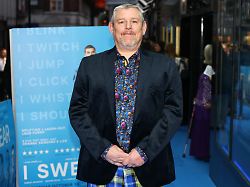 london england september 29 john davidson attends the london gala screening of i swear at the curzon mayfair on september 29 2025 in london england photo by tim p