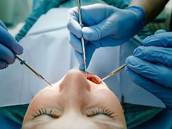 machen die weisheitszaehne probleme muessen sie raus ein termin vor dem viele betroffene angst haben