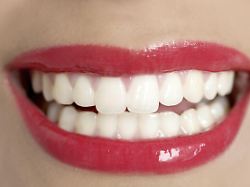 schoene frau perfekte zaehne laecheln mit roten lippen modellfreigabe vorhanden