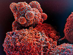 colorized scanning electron micrograph of a cell red infected with the omicron strain of sars cov 2 virus particles blue isolated from a patient sample