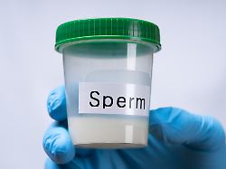 doctor holding sperm donor container 22 02