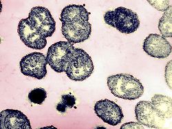neisseria gonorrhoeae