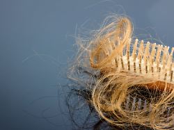 haarbuerste mit haare eine haarbuerste mit haeren beginn von haarausfall und alopezie copyright xzoonar
