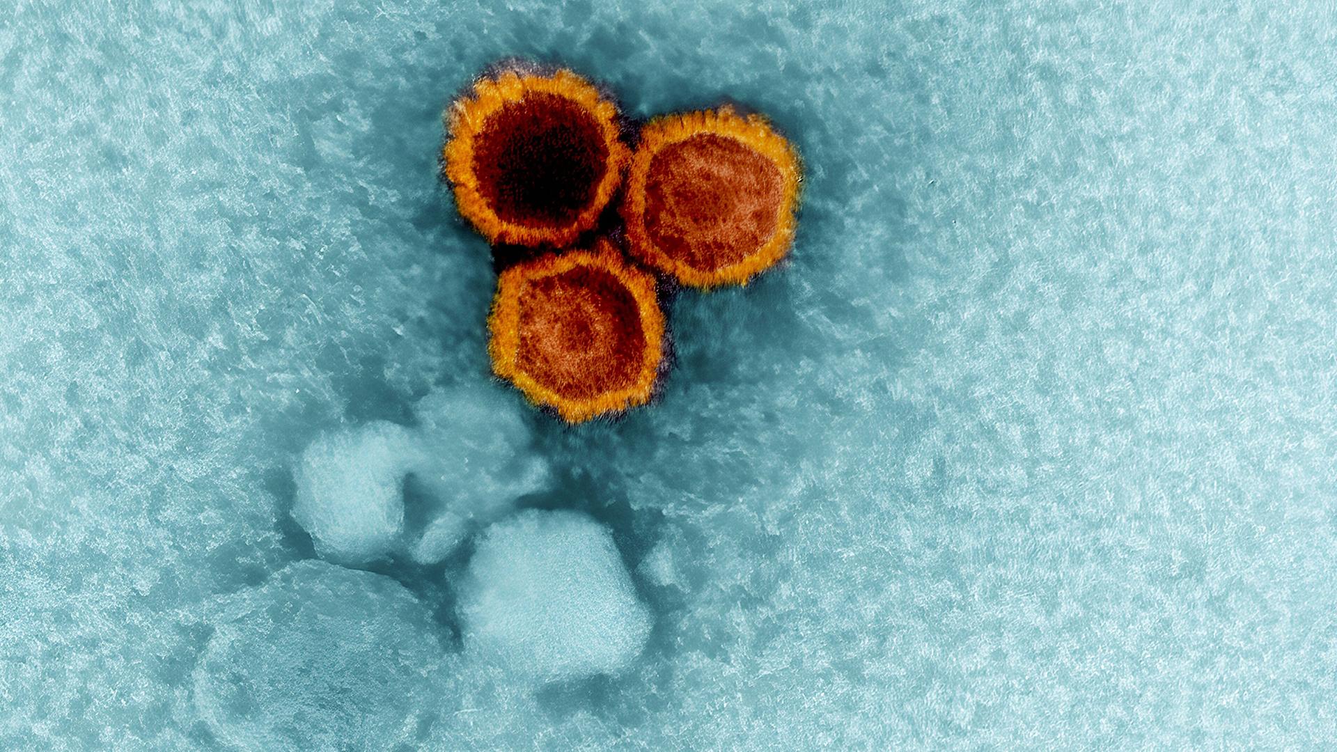 epstein barr virus 102