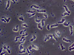 a wet mount of naegleria fowleri trophozoites cultured from the cerebrospinal fluid of a patient with primary amoebic meningoencephalitis seen by phase contrast microscopy