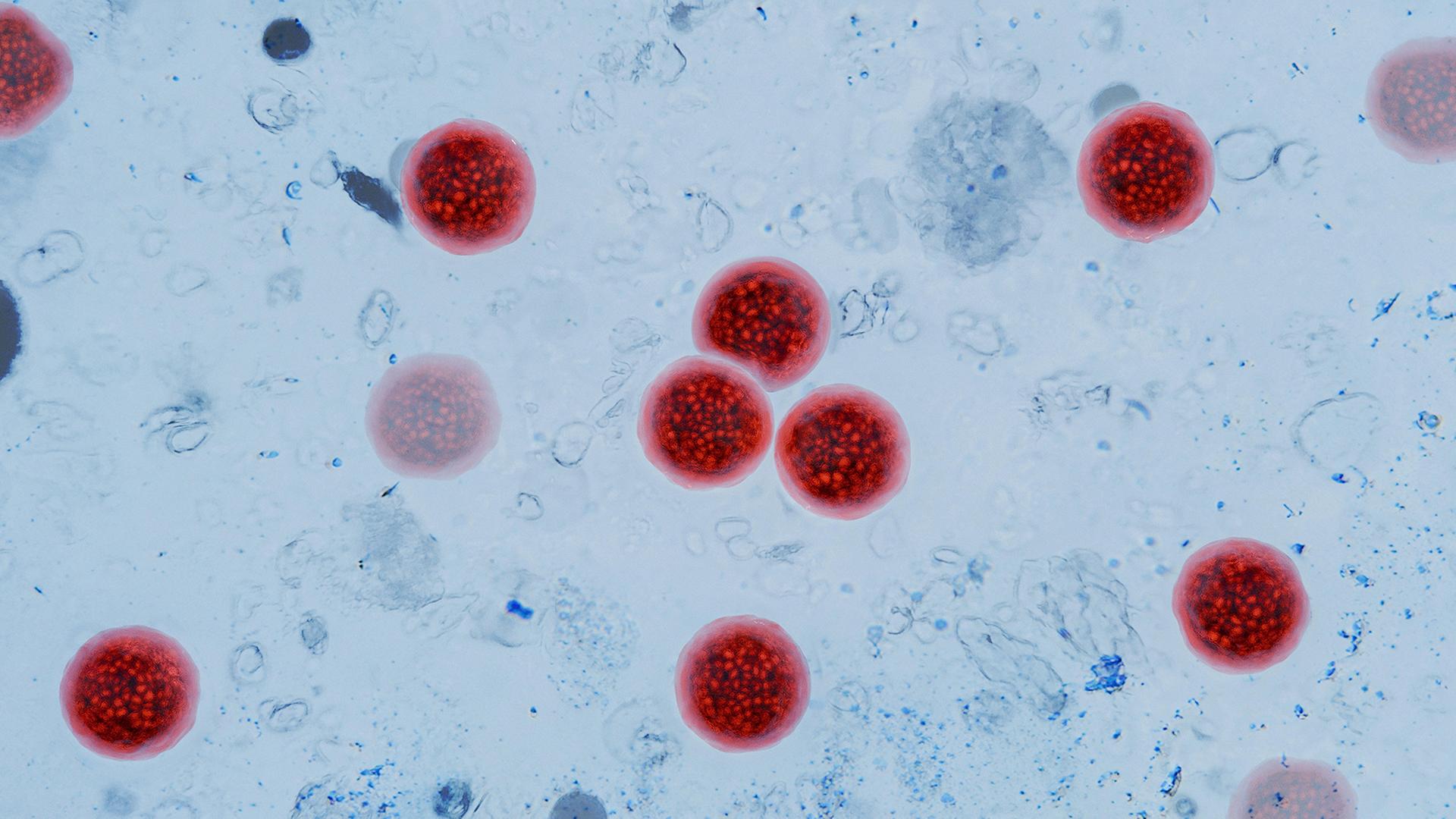 cyclosporiasis 100
